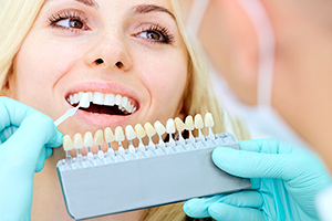 Реставрация зубов винирами в визит стома