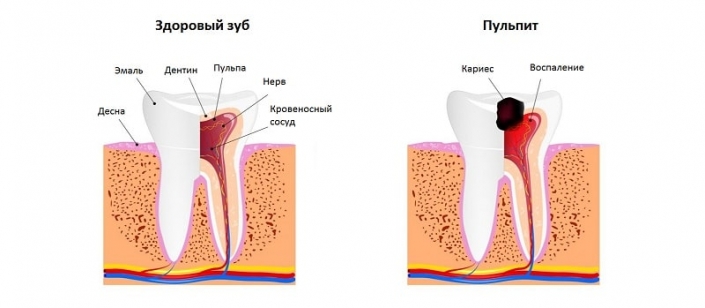 Полость проникнуть