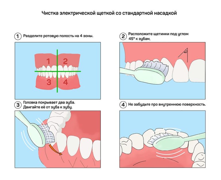 Схема чистки зубов